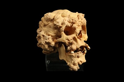 Lot 109 - A RESIN MODEL OF THE SKULL OF THE ELEPHANT MAN, JOSEPH MERRICK *AMENDED