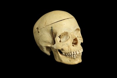 Lot 111 - A MEDICAL STUDY HUMAN SKULL