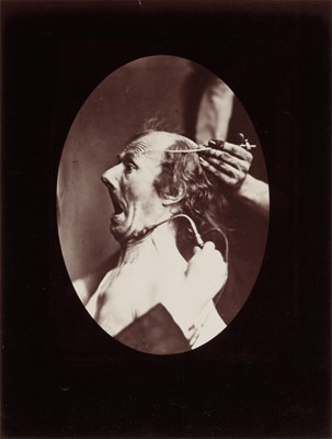 Lot 2 - Guillaume Benjamin Duchenne de Boulogne (1806-1875)