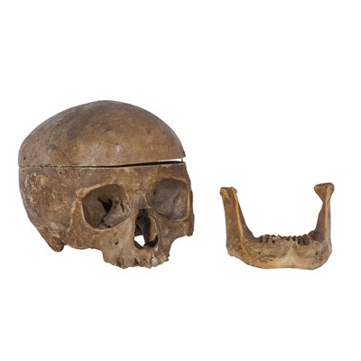 Lot 362 - 19th Century Anatomical Medical Human Skull